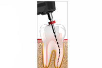 Thumb integrated length determination